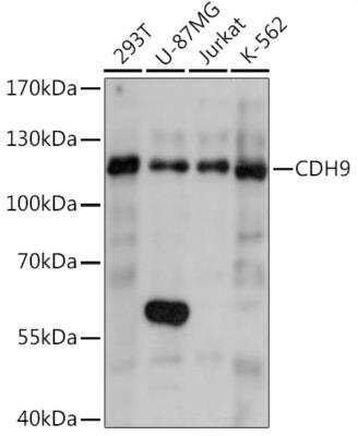 Western Blot: Cadherin-9 Antibody [NBP2-92182] - Western blot analysis of extracts of various cell lines, using Cadherin-9 antibody at 1:1000 dilution. Secondary antibody: HRP Goat Anti-Rabbit IgG (H+L) at 1:10000 dilution. Lysates/proteins: 25ug per lane. Blocking buffer: 3% nonfat dry milk in TBST. Detection: ECL Basic Kit. Exposure time: 10s.
