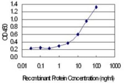 Sandwich ELISA: Calbindin D-28K Antibody (1F6) [H00000793-M01] - Detection limit for recombinant GST tagged CALB1 is 0.3 ng/ml as a capture antibody.