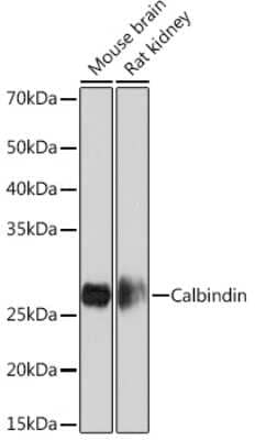 Western Blot: Calbindin D-28K Antibody (1K2K2) [NBP3-16209] - Western blot analysis of extracts of various cell lines, using Calbindin D-28K Rabbit mAb (NBP3-16209) at 1:1000 dilution. Secondary antibody: HRP Goat Anti-Rabbit IgG (H+L) at 1:10000 dilution. Lysates/proteins: 25ug per lane. Blocking buffer: 3% nonfat dry milk in TBST. Detection: ECL Basic Kit. Exposure time: 5s.