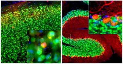 Immunocytochemistry/Immunofluorescence: Calbindin D-28K Antibody (5A9) [NBP2-50050] - Adult mouse cortex (Left) and cerebellum (Right) sections were stained with NBP2-50050 in red, and co-stained with rabbit polyclonal anti-RBFOX3/NeuN antibody (NBP1-92716, green). Calbindin is expressed in a subset of interneurons in the cortex (Left) and prominently expressed in the dendrites of Purkinje cells in the cerebellum molecular layer (Right). RBFOX3/NeuN expresses in most neurons; as a result, cells positive for Calbindin appear to be yellow. Insets are high magnification images of the boxed area. Blue is Dapi nucleus staining that labels DNA.