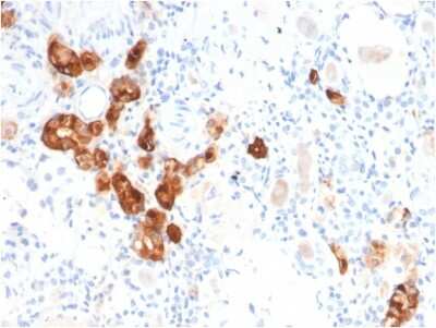 Immunohistochemistry-Paraffin: Calbindin D-28K Antibody (CALB1/2782) [NBP3-07208] - Formalin-fixed, paraffin-embedded human Kidney stained with Calbindin D-28K Mouse Monoclonal Antibody (CALB1/2782).