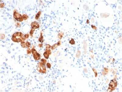 Immunohistochemistry-Paraffin: Calbindin D-28K Antibody (CALB1/2782) [NBP3-08954] - Formalin-fixed, paraffin-embedded human Kidney stained with Calbindin D-28K Mouse Monoclonal Antibody (CALB1/2782).