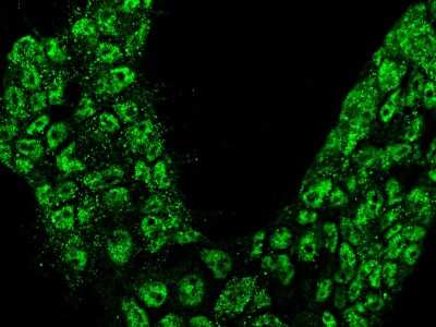 Immunocytochemistry/Immunofluorescence: Calbindin D-28K Antibody [NBP2-99063] - Immunofluorescence staining of Calbindin D-28K in 293 cells. Cells were fixed with 4% PFA, blocked with 10% serum, and incubated with rabbit anti-human Calbindin D-28K polyclonal antibody (1:1000) at 4C overnight. Then cells were stained with the Alexa Fluor(R)488-conjugated Goat Anti-rabbit IgG Secondary antibody (green).Positive staining was localized to cytoplasm and nucleus.