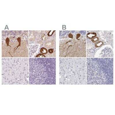 <b>Independent Antibodies Validation and Orthogonal Strategies Validation.</b>Immunohistochemistry-Paraffin: Calbindin D-28K Antibody [NBP1-86664] - Staining of human cerebellum, kidney, liver and lymph node using Anti-CALB1 antibody NBP1-86664 (A) shows similar protein distribution across tissues to independent antibody NBP2-38798 (B).