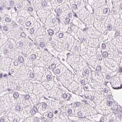 Immunohistochemistry-Paraffin: Calbindin D-28K Antibody [NBP1-86664] - Staining of human liver.