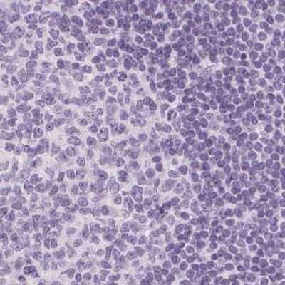 Immunohistochemistry-Paraffin: Calbindin D-28K Antibody [NBP1-86664] - Staining of human lymph node using Anti-CALB1 antibody NBP1-86664.