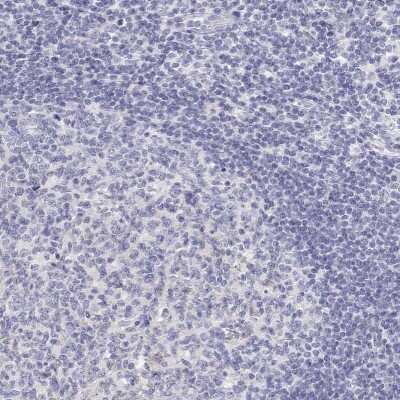 Immunohistochemistry-Paraffin: Calbindin D-28K Antibody [NBP2-38798] - Staining of human lymph node shows low expression as expected.