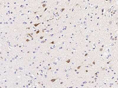 Immunohistochemistry-Paraffin: Calbindin D-28K Antibody [NBP2-99063] - Immunochemical staining of human Calbindin D-28K in human brain with rabbit polyclonal antibody (1:1000, formalin-fixed paraffin embedded sections).