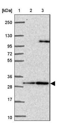 Western Blot: Calbindin D-28K Antibody [NBP2-38798] - Lane 1: Marker  [kDa] 250, 130, 95, 72, 55, 36, 28, 17, 10.  Lane 2: Human cell line RT-4.  Lane 3: Human cell line U-251MG