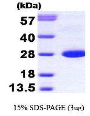 SDS-PAGE Recombinant Human Calbindin D-28K Protein