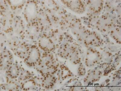 Immunohistochemistry-Paraffin: Calcineurin A Antibody (2G8) [H00005530-M03] - Analysis of monoclonal antibody to PPP3CA on formalin-fixed paraffin-embedded human stomach. Antibody concentration 1.5 ug/ml