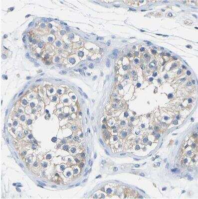 Immunohistochemistry-Paraffin: Calcineurin A Antibody [NBP1-88218] - Staining of human testis shows weak membranous positivity in cells in seminiferous ducts.