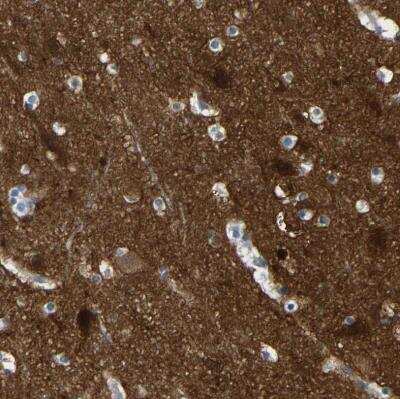 Immunohistochemistry-Paraffin: Calcineurin A Antibody [NBP1-88218] - Staining of human cerebral cortex shows strong cytoplasmic positivity in neuropil.