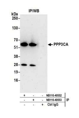 <b>Independent Antibodies Validation. </b>Immunoprecipitation: Calcineurin A Antibody [NB110-40553] - Detection of human Calcineurin A (PPP3CA) by western blot of immunoprecipitates. Samples: Whole cell lysate (1.0 mg per IP reaction; 20% of IP loaded) from HeLa cells prepared using NETN lysis buffer. Antibodies: Affinity purified rabbit anti-Calcineurin A antibody NB110-40553 used for IP at 3 ug per reaction. Calcineurin A was also immunoprecipitated by rabbit anti-Calcineurin A antibody NB110-40552. For blotting immunoprecipitated Calcineurin A, NB110-40553 was used at 1 ug/ml. Detection: Chemiluminescence with an exposure time of 30 seconds.