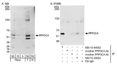 Western Blot: Calcineurin A Antibody [NB110-40552] - Detection of Human and Mouse PPP3CA on HeLa whole cell lysate using NB110-40552. PPP3CA was also immunoprecipitated by other rabbit anti-PPP3CA antibodies and NB110-40553.