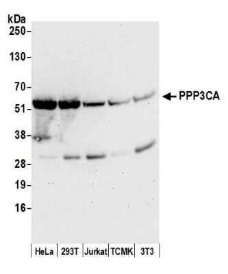 Western Blot: Calcineurin A Antibody [NB110-40553] - Detection of human and mouse PPP3CA by western blot. Samples: Whole cell lysate (50 ug) from HeLa, HEK293T, Jurkat, mouse TCMK-1, and mouse NIH 3T3 cells prepared using NETN lysis buffer. Antibody: Affinity purified rabbit anti-PPP3CA antibody NB110-40553 used for WB at 0.1 ug/ml. Detection: Chemiluminescence with an exposure time of 30 seconds.