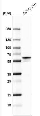 Western Blot: Calcineurin A Antibody [NBP1-88218] - Analysis in human cell line SCLC-21H.