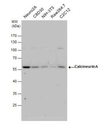 Western Blot: Calcineurin A Antibody [NBP2-15663] - Various whole cell extracts (30 ug) were separated by 10% SDS-PAGE, and the membrane was blotted with Calcineurin A antibody diluted by 1:3000.