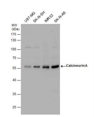 Western Blot: Calcineurin A Antibody [NBP2-15663] -  Various whole cell extracts (30 ug) were separated by 10% SDS-PAGE, and the membrane was blotted with Calcineurin A antibody diluted by 1:3000.