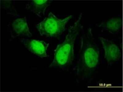 Immunocytochemistry/Immunofluorescence: Calcineurin B Antibody (4E1) [H00005534-M01] - Analysis of monoclonal antibody to PPP3R1 on HeLa cell. Antibody concentration 25 ug/ml.