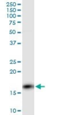 Western Blot: Calcineurin B Antibody (4E1) [H00005534-M01] - PPP3R1 monoclonal antibody (M01), clone 4E1. Analysis of PPP3R1 expression in rat brain.