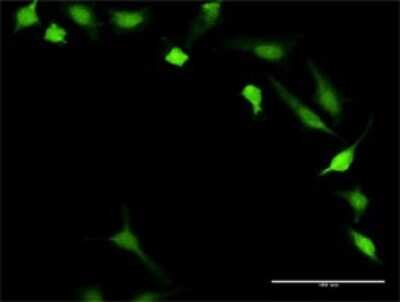 Immunocytochemistry/Immunofluorescence: Calcineurin B Antibody [H00005534-D01P] - Analysis of antibody to PPP3R1 on HeLa cell. Antibody concentration 10 ug/ml.
