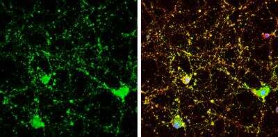 Immunocytochemistry/Immunofluorescence: Calcineurin B Antibody [NBP2-15664] - Calcineurin B antibody detects Calcineurin B protein by immunofluorescent analysis.Sample: DIV9 rat E18 primary cortical neuron cells were fixed in 4% paraformaldehyde at RT for 15 min. Green: Calcineurin B stained by Calcineurin B antibody diluted at 1:500. Red: beta Tubulin 3/ Tuj1, stained by beta Tubulin 3/ Tuj1 antibody diluted at 1:500. Blue: Fluoroshield with DAPI.