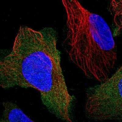 Immunocytochemistry/Immunofluorescence: Calcineurin B Antibody [NBP2-46745] - Staining of human cell line U-2 OS shows localization to plasma membrane. Antibody staining is shown in green.