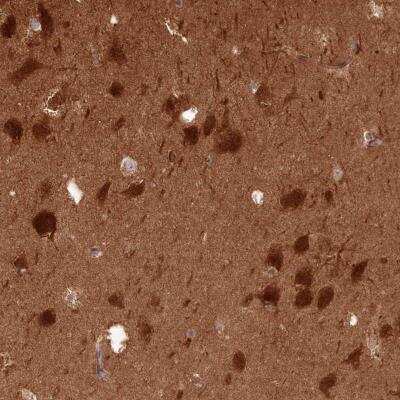 Immunohistochemistry-Paraffin: Calcineurin B Antibody [NBP2-46745] - Staining of human hippocampus shows strong cytoplasmic positivity in neuronal cells.