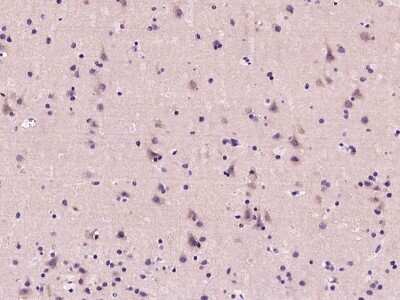 Immunohistochemistry: Calcineurin B Antibody [NBP2-99441] - Immunochemical staining Calcineurin B  in human brain with rabbit polyclonal antibody at 1:200 dilution, formalin-fixed paraffin embedded sections.