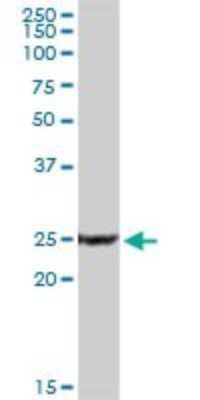 Western Blot: Calcineurin B Antibody [H00005534-D01P] - Analysis of PPP3R1 expression in human liver.