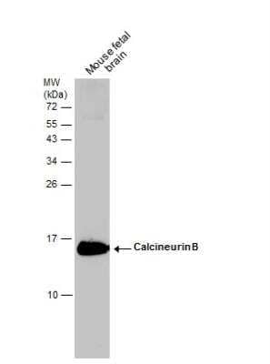 Western Blot: Calcineurin B Antibody [NBP1-32720] - Mouse tissue extract (50 ug) was separated by 15% SDS-PAGE, and the membrane was blotted with Calcineurin B antibody diluted at 1:1000.