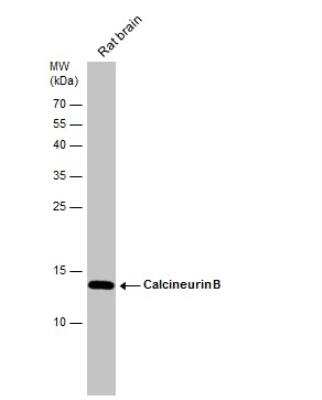 Western Blot: Calcineurin B Antibody [NBP1-32720] - Rat tissue extract (50 ug) was separated by 15% SDS-PAGE, and the membrane was blotted with Calcineurin B antibody diluted at 1:100000.