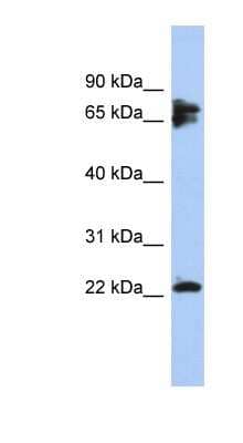 Western Blot: Calcineurin B Antibody [NBP1-56816] - NCI-H226 cell lysate, concentration 0.2-1 ug/ml.