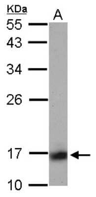 Western Blot: Calcineurin B Antibody [NBP2-15664] - Sample (30 ug of whole cell lysate) A: IMR32 12% SDS PAGE gel, diluted at 1:1000.