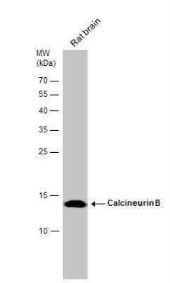 Western Blot: Calcineurin B Antibody [NBP2-15664] - Rat tissue extract (50 ug) was separated by 15% SDS-PAGE, and the membrane was blotted with Calcineurin B antibody diluted at 1:50000.