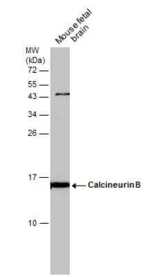 Western Blot: Calcineurin B Antibody [NBP2-15664] - Mouse tissue extract (50 ug) was separated by 15% SDS-PAGE, and the membrane was blotted with Calcineurin B antibody diluted at 1:1000.