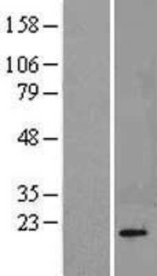 Western Blot: Calcineurin B Overexpression Lysate (Adult Normal) [NBL1-14707] Left-Empty vector transfected control cell lysate (HEK293 cell lysate); Right -Over-expression Lysate for Calcineurin B.