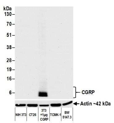 Western Blot: Calcitonin Antibody (BLR169J) [NBP3-14743] - Whole cell lysate (50 ug) from NIH 3T3, CT26, NIH 3T3 + 1 ug purified mouse CGRP, TCMK-1, and BW5147.3 cells prepared using NETN lysis buffer. Antibody:  Rabbit anti-CGRP recombinant monoclonal antibody used at 1:1000. Secondary:  HRP-conjugated goat anti-rabbit IgG. Chemiluminescence with an exposure time of 10 seconds. Lower Panel: Rabbit anti-Actin recombinant monoclonal antibody.