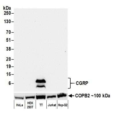 Western Blot: Calcitonin Antibody (BLR169J) [NBP3-14743] -  Whole cell lysate (50 ug) from NIH 3T3, CT26, NIH 3T3 + 1 ug purified mouse CGRP, TCMK-1, and BW5147.3 cells prepared using NETN lysis buffer.  Rabbit anti-CGRP recombinant monoclonal antibody  used at 1:1000.  Secondary  HRP-conjugated goat anti-rabbit IgG. Chemiluminescence with an exposure time of 3 seconds. Lower Panel: Rabbit anti-COPB2 antibody.