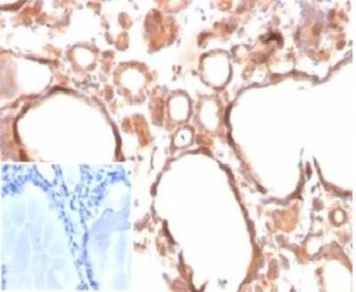 Immunohistochemistry-Paraffin: Calcitonin Antibody (CALCA/3310) [NBP3-13800] - Formalin-fixed, paraffin-embedded human thyroid stained with Calcitonin antibody (CALCA/3310). Inset: PBS instead of primary antibody; secondary only negative control.