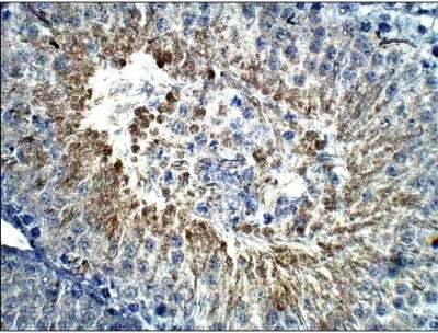 Immunohistochemistry-Paraffin: Calcitonin Antibody [NBP3-12261] - Rat Testis-Calcitonin. 1:50 dilution in IHC Blocking Buffer. DAB (brown) straining and Hematoxylin QS (blue) counterstrain. 40x Magnification. FFPE section.