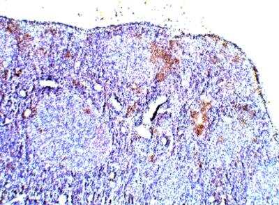 Immunohistochemistry-Paraffin: Calcitonin Antibody [NBP3-12293] - Rat thyroid. 1:100 dilution in IHC blocking buffer. DAB (brown) staining and Hematoxylin QS (blue) counterstain. 5X mangification.