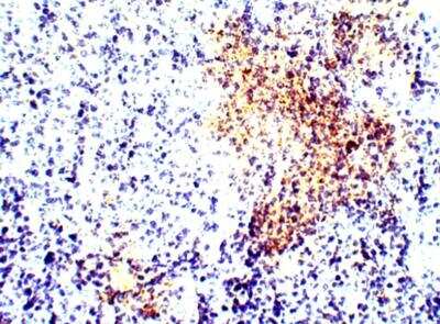 Immunohistochemistry-Paraffin: Calcitonin Antibody [NBP3-12293] - Rat thyroid. 1:100 dilution in IHC blocking buffer. DAB (brown) staining and Hematoxylin QS (blue) counterstain. 40X mangification.