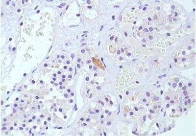 Immunohistochemistry-Paraffin: Calcitonin Antibody (SP17) [NBP2-26483] - Human Pituitary.