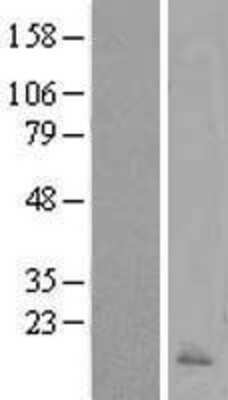 Western Blot Calcitonin Overexpression Lysate