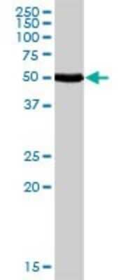 Western Blot: Calcitonin R Antibody [H00000799-D01P] - Analysis of CALCR expression in human kidney.