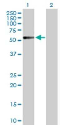 Western Blot: Calcitonin R Antibody [H00000799-D01P] - Analysis of CALCR expression in transfected 293T cell line by CALCR polyclonal antibody.Lane 1: CALCR transfected lysate(55.30 KDa).Lane 2: Non-transfected lysate.