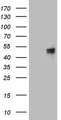 Western Blot: Calcium Activated Nucleotidase 1/CANT1 Antibody (OTI7F8) - Azide and BSA Free [NBP2-72378] - Analysis of HEK293T cells were transfected with the pCMV6-ENTRY control (Left lane) or pCMV6-ENTRY Calcium Activated Nucleotidase 1.