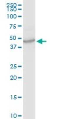 Western Blot: Calcium Activated Nucleotidase 1/CANT1 Antibody [H00124583-D01P] - Analysis of CANT1 expression in HeLa.